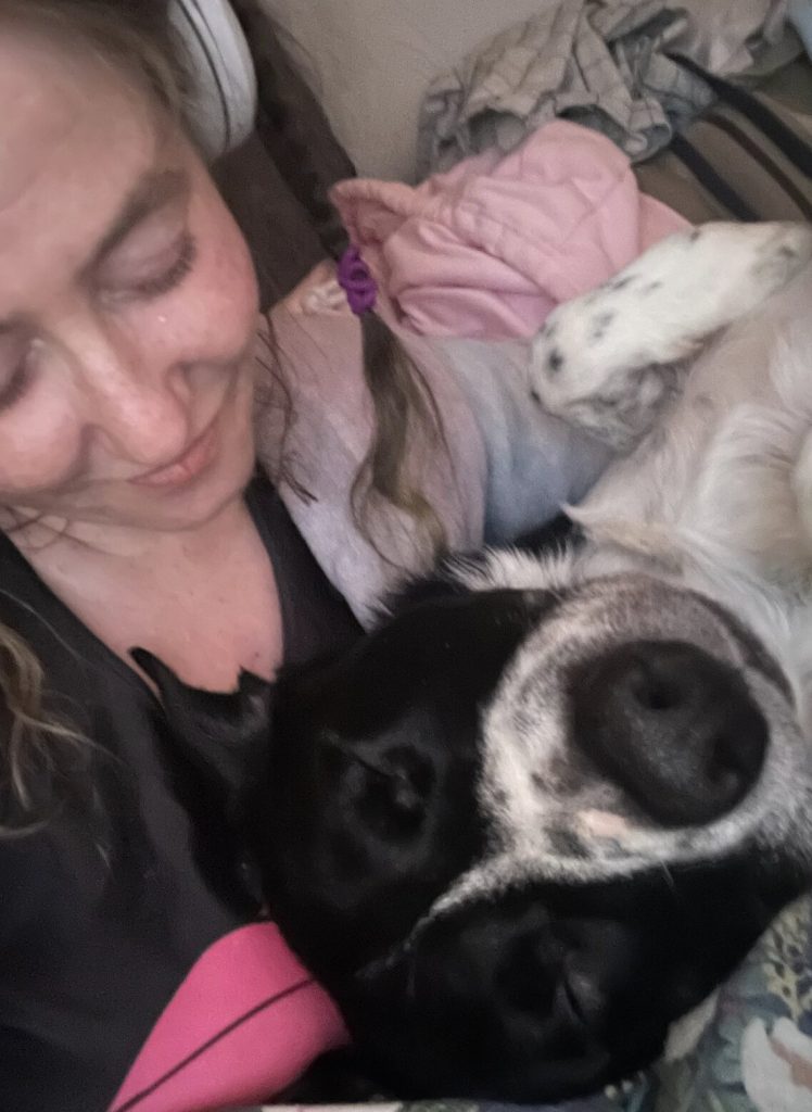 Type 1 diabetic Jayme Stephen, 39, had her leg amputated after accidentally standing on a dropped dog biscuit triggered a horror sepsis infection.