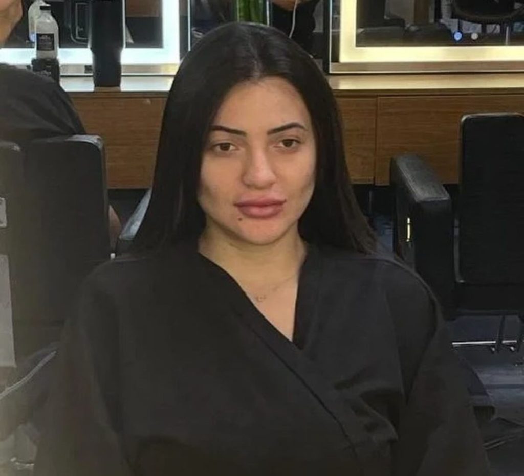 A Brazilian woman was arrested after stabbing her hairdresser in the back over a haircut dispute, having spent weeks threatening him with death if he refused to give her a refund.
