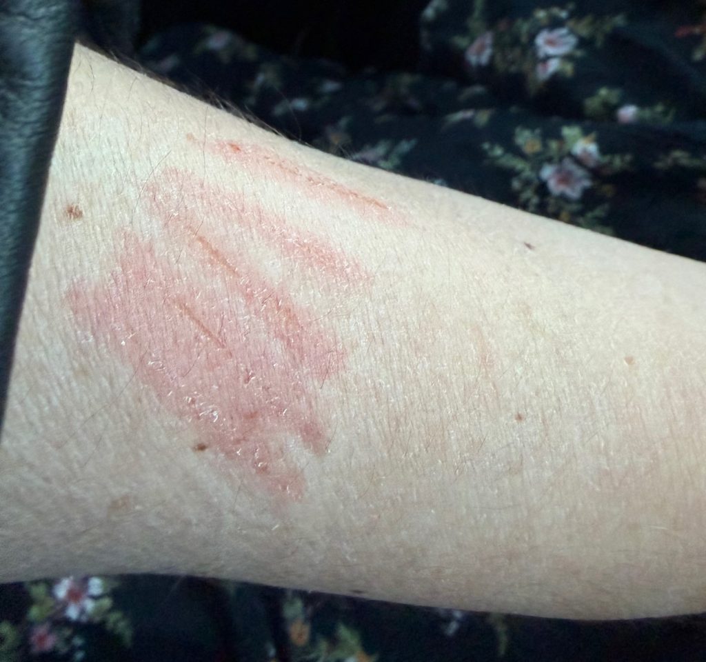 Ghost hunter Brocarde claims she was scratched by demonic child spirit 'Sallie' while spending the night in haunted Kansas house - left bedbound for days.