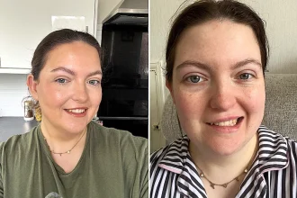 A mum thought her itchy ear was just an infection - but it spiralled into Ramsay Hunt Syndrome, leaving her with terrifying facial paralysis down one side of her face.