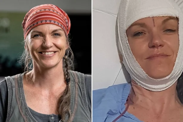 Aussie scientist Dr Pia Winberg, 55, was scalped by machine then walked 200 metres clutching her own scalp to find help, in horror lab accident.