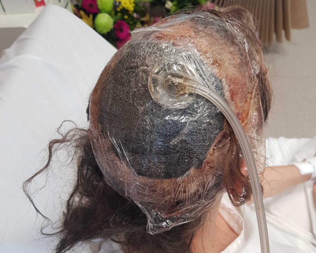 Aussie scientist Dr Pia Winberg, 55, was scalped by machine then walked 200 metres clutching her own scalp to find help, in horror lab accident.