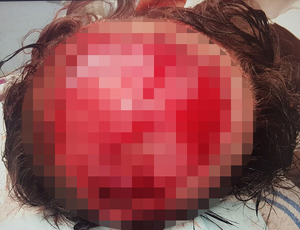 Aussie scientist Dr Pia Winberg, 55, was scalped by machine then walked 200 metres clutching her own scalp to find help, in horror lab accident.