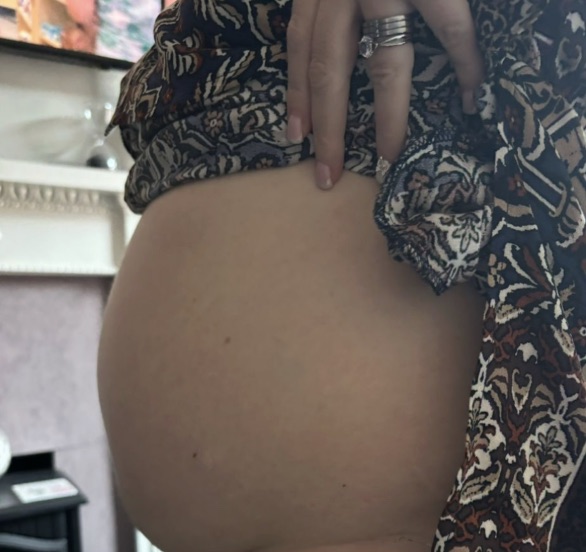 Friends asked Sally-Anne if she was pregnant - but it was actually a life-threatening tumour that burst while she was relaxing in the bath. Her story could save lives.