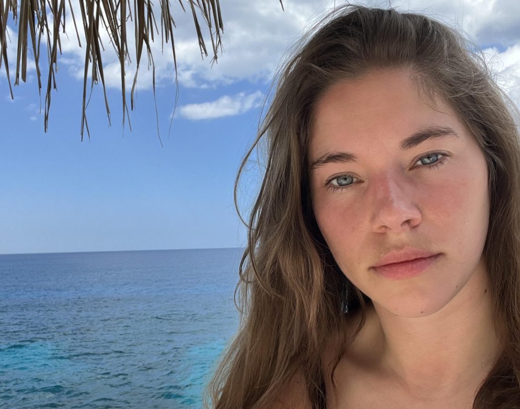 Alexie shattered her face in a horror hiking fall and covered every mirror at home - now she's sharing her raw recovery journey to help others heal.