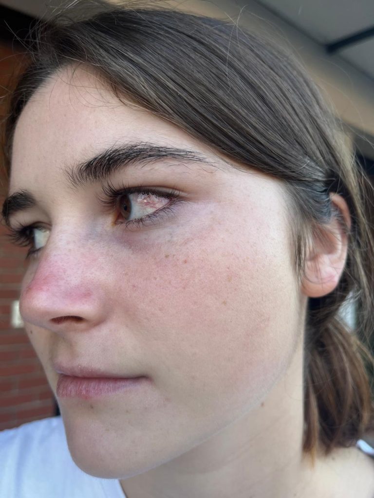 Student with rare eye cancer reveals the heartbreaking moment she first saw herself in the mirror after surgery to remove her eye - and how she learned to accept it.