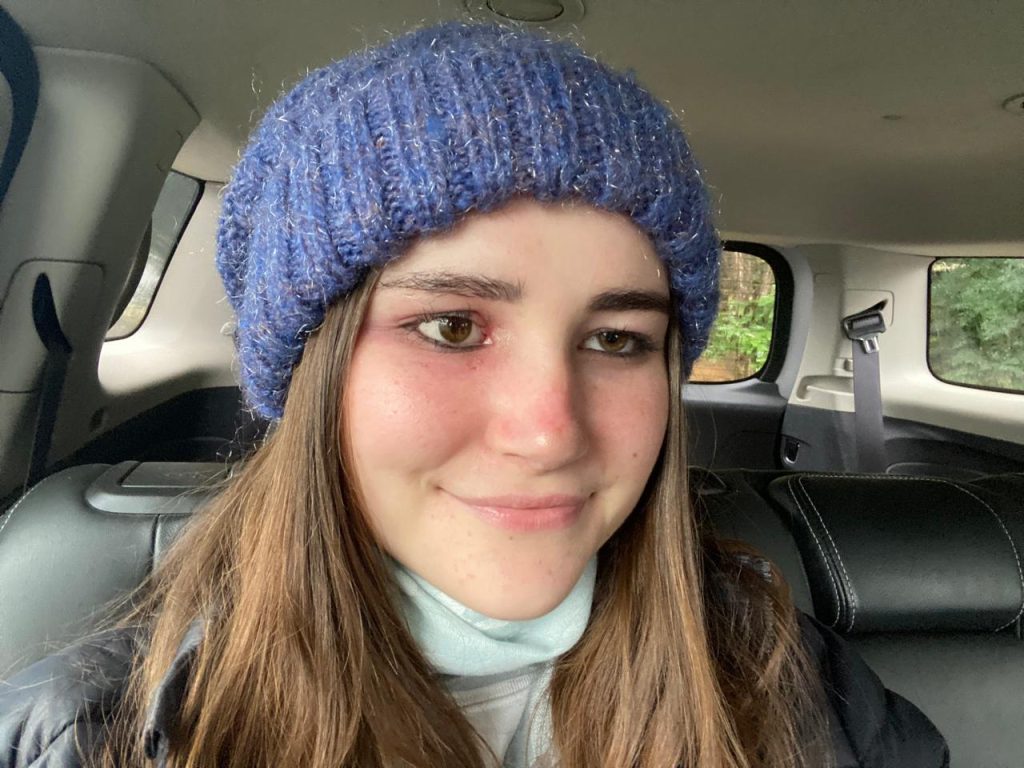 Student with rare eye cancer reveals the heartbreaking moment she first saw herself in the mirror after surgery to remove her eye - and how she learned to accept it.