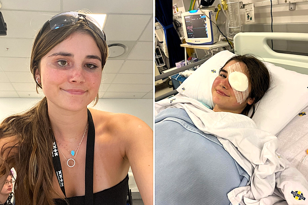 Student with rare eye cancer reveals the heartbreaking moment she first saw herself in the mirror after surgery to remove her eye - and how she learned to accept it.