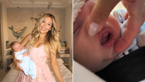 Miami mum Ali Pilossoph, 29, shares heartbreak after a white lump on her newborn son Theo's gums turned out to be ultra-rare tumour.