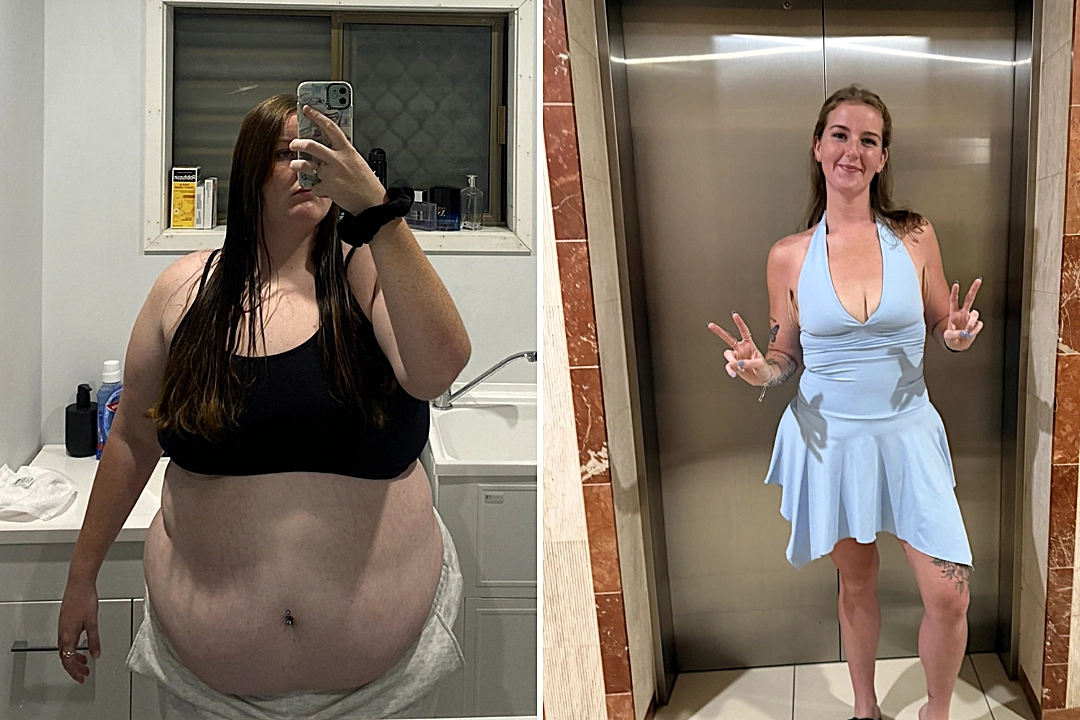 Aussie Lara, 22, shed an incredible 10 stone after years of hiding behind friends in photos - now she barely recognises her miserable former self.