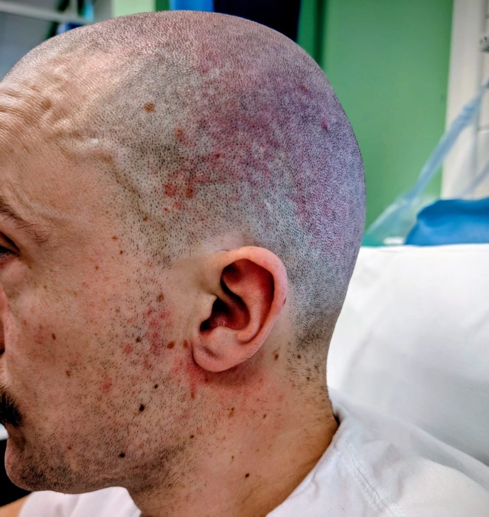 A man going through cancer treatment was left £4,500 in debt due to his employer's payroll error - and told it would only be wiped if he deleted his social media posts.