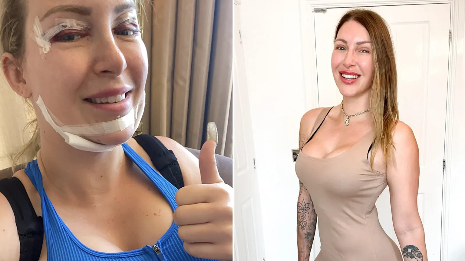 A British mum who spent £100,000 on four boob jobs, a BBL and countless other procedures is ditching surgery for good and embracing her natural look for the first time in 20 years.