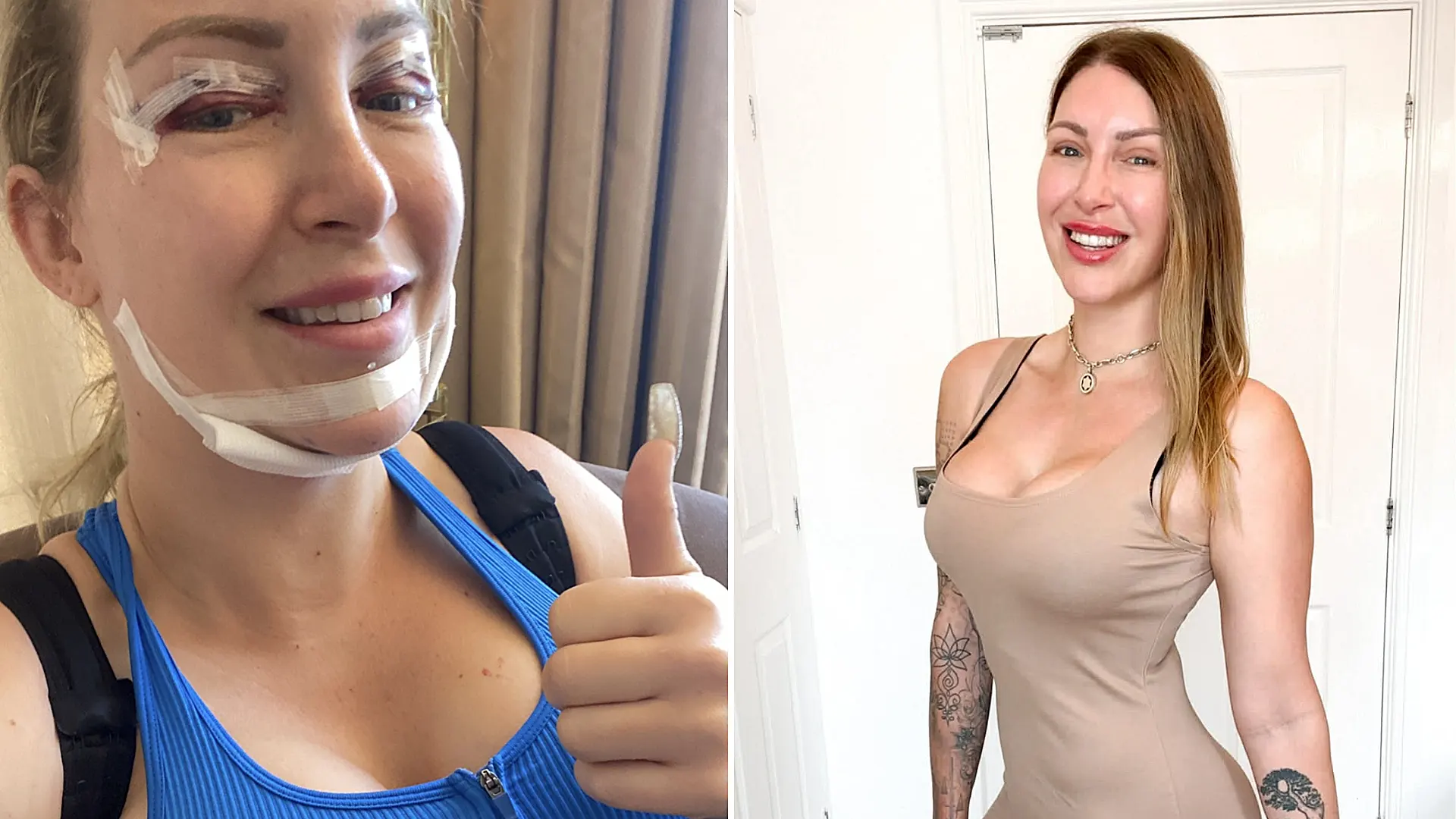 A British mum who spent £100,000 on four boob jobs, a BBL and countless other procedures is ditching surgery for good and embracing her natural look for the first time in 20 years.