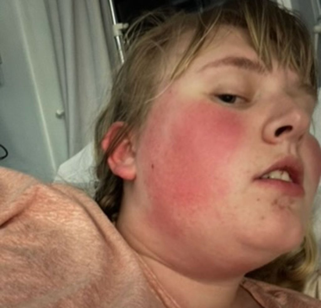 A British student says she can only eat 25 foods without risking death as her body keeps developing new allergies - and her dog Kenny gives her a 10-minute warning before each attack.
