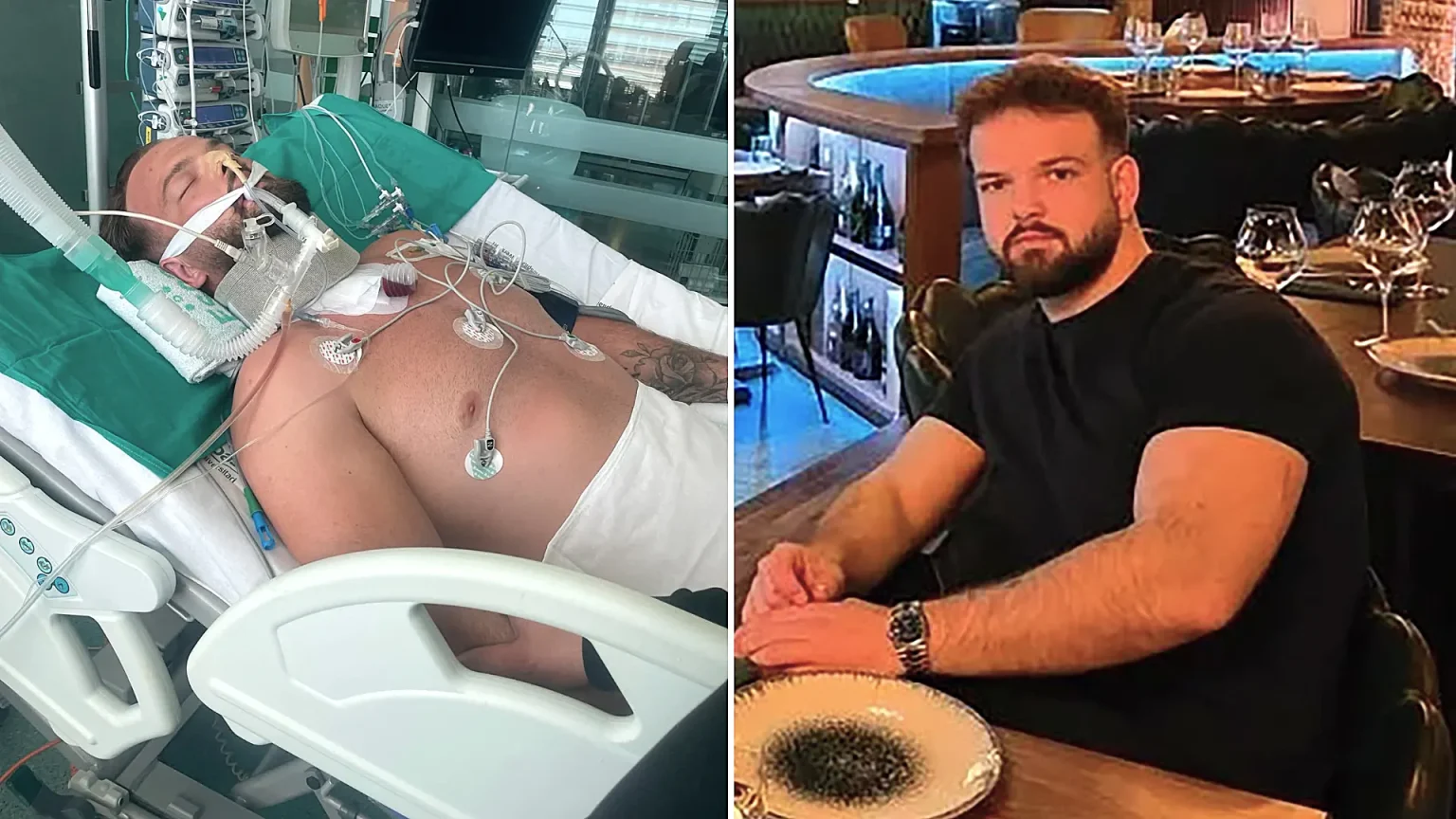 A 27-year-old Brit has been told he may never walk again after a holiday dive fractured four parts of his spine - he told bystanders he couldn't feel his legs as he lay on the beach.