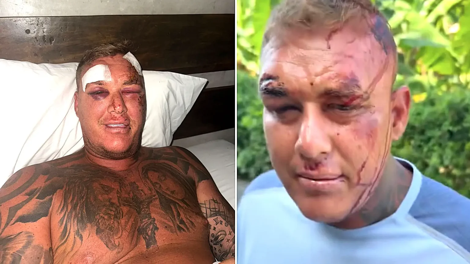 A British tourist claims he was drugged and robbed of £1,800 in Bali after a woman spiked his drinks on a night out - leaving him with two head wounds and 23 stitches.