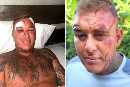 A British tourist claims he was drugged and robbed of £1,800 in Bali after a woman spiked his drinks on a night out - leaving him with two head wounds and 23 stitches.