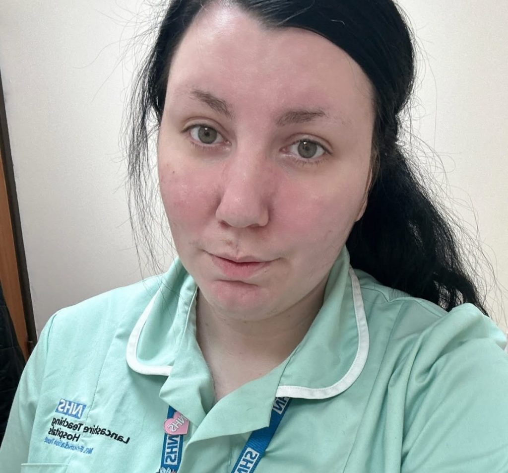 An NHS healthcare assistant spent five years battling stroke-like symptoms doctors called a mystery - at 29 she was finally diagnosed with multiple sclerosis and is now living again.