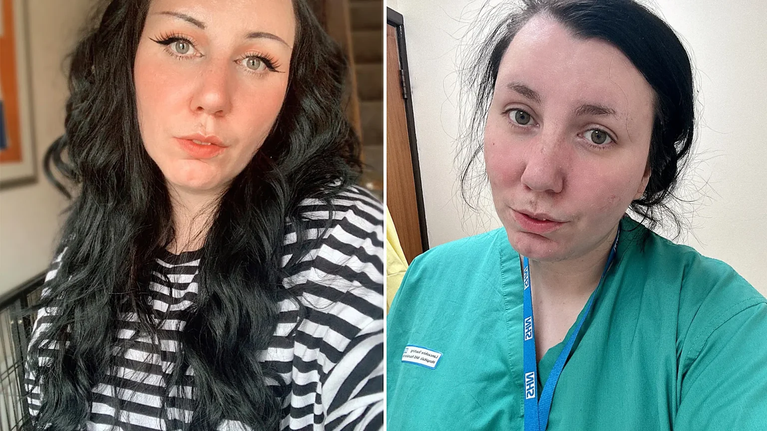 An NHS healthcare assistant spent five years battling stroke-like symptoms doctors called a mystery - at 29 she was finally diagnosed with multiple sclerosis and is now living again.