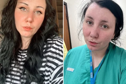 An NHS healthcare assistant spent five years battling stroke-like symptoms doctors called a mystery - at 29 she was finally diagnosed with multiple sclerosis and is now living again.