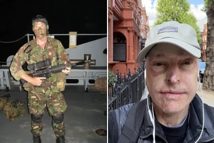 Pilot who could smell his own flesh burning as his plane caught fire at 32 reveals the daily five-mile walk he does to "survive" after burns to 63% of his body.