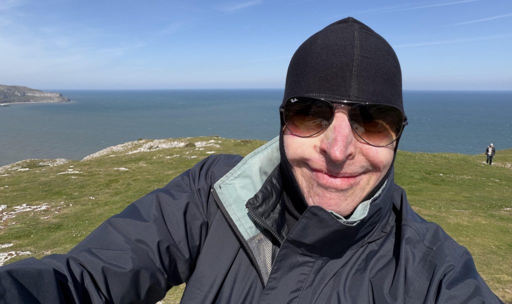Pilot who could smell his own flesh burning as his plane caught fire at 32 reveals the daily five-mile walk he does to "survive" after burns to 63% of his body.