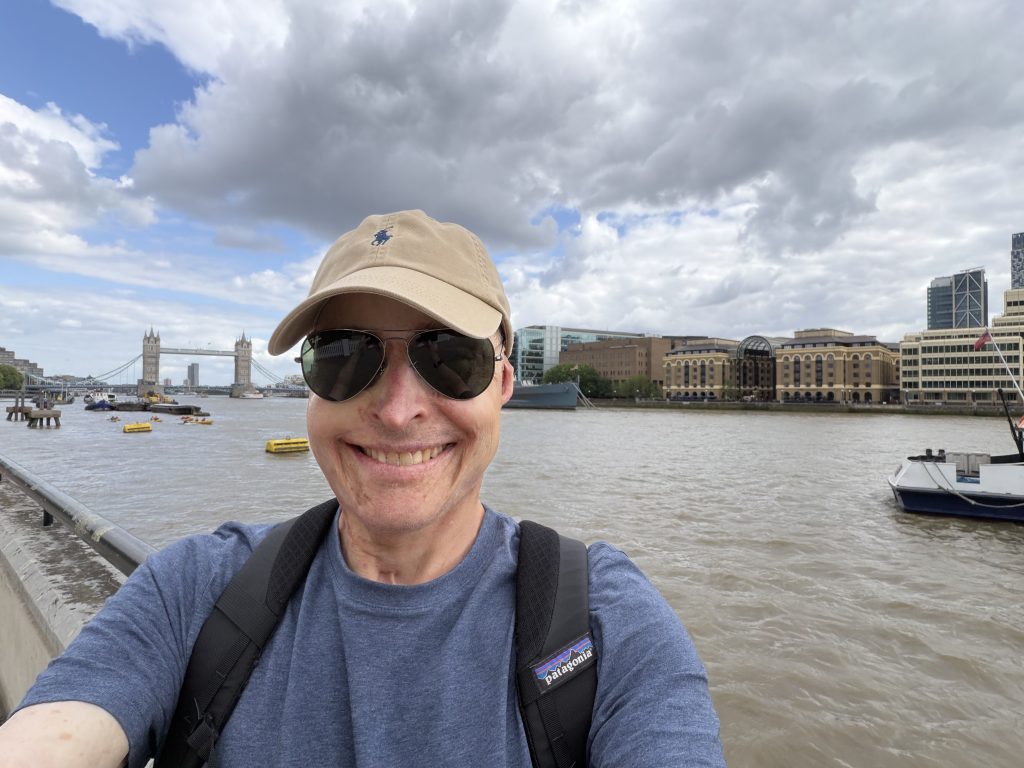 Pilot who could smell his own flesh burning as his plane caught fire at 32 reveals the daily five-mile walk he does to "survive" after burns to 63% of his body.