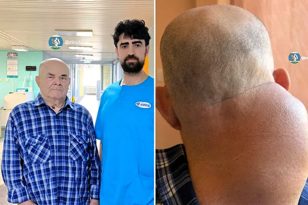 Russian surgeons spent two hours removing a rare neck liposarcoma the size of a human head from an elderly man, after the 2kg tumour had begun advancing towards his spine.