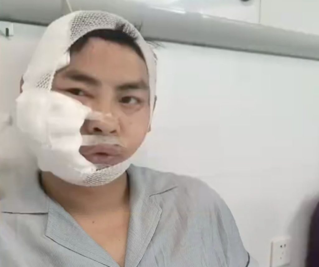 A tourist was bitten on the head and face by a 10ft shark seconds into an aquarium diving experience - staff had reportedly told visitors it was safe enough for children.