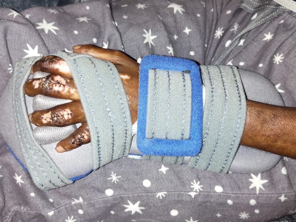 A mum who mistook her rashes and joint pain for stress was diagnosed with a rare incurable disease attacking her vital organs - and has no idea how long she has left.