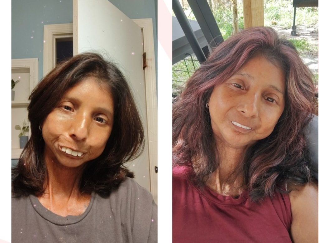 A mum who mistook her rashes and joint pain for stress was diagnosed with a rare incurable disease attacking her vital organs - and has no idea how long she has left.