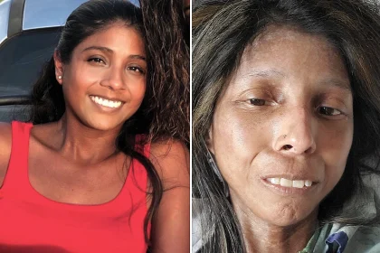 A mum who mistook her rashes and joint pain for stress was diagnosed with a rare incurable disease attacking her vital organs - and has no idea how long she has left.