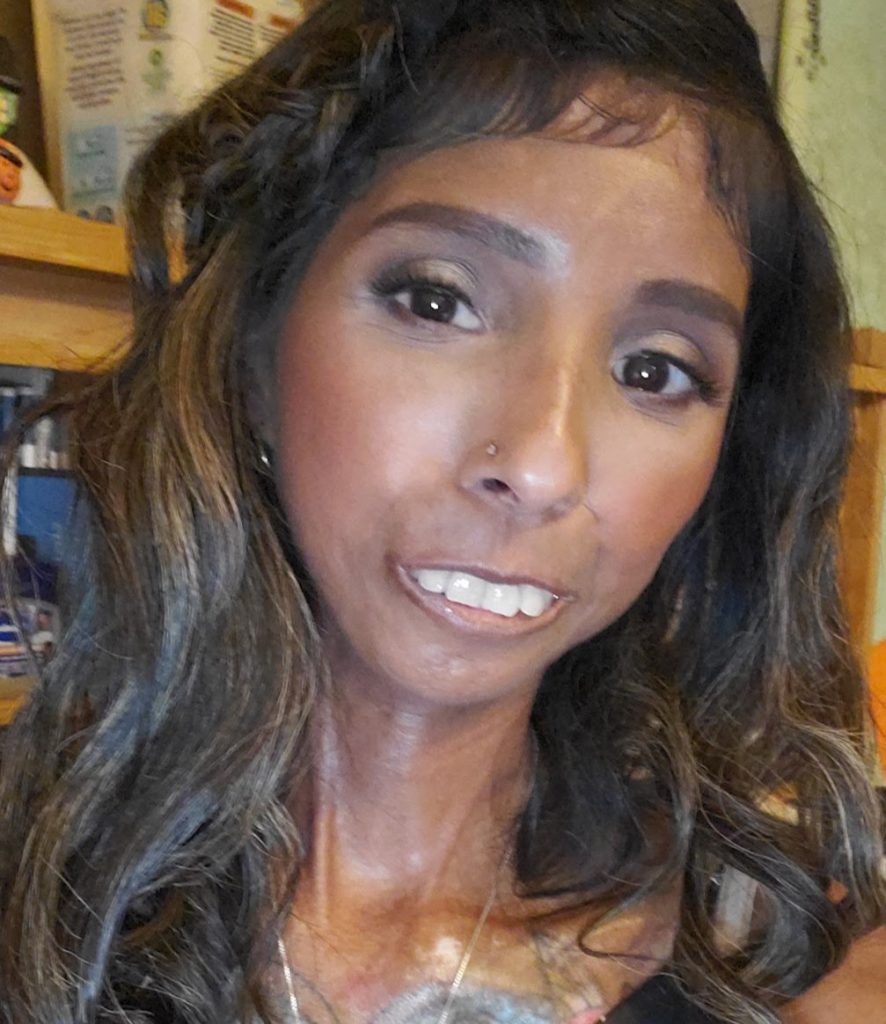 A mum who mistook her rashes and joint pain for stress was diagnosed with a rare incurable disease attacking her vital organs - and has no idea how long she has left.