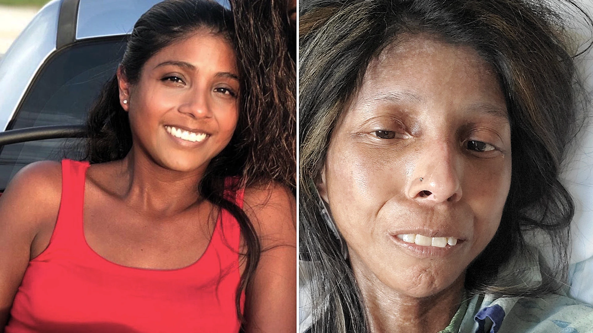 A mum who mistook her rashes and joint pain for stress was diagnosed with a rare incurable disease attacking her vital organs - and has no idea how long she has left.