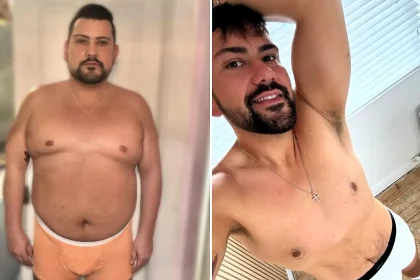 Told he'd never reach 40, a Belfast man lost nine stone on Mounjaro and used a daily six-step skincare routine to avoid surgery - and stunned his tummy tuck surgeons.