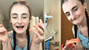 A 25-year-old who had all her teeth pulled at just 22 due to severe vitamin deficiencies is hitting back at cruel online trolls who say she looks 75 and used hard drugs.
