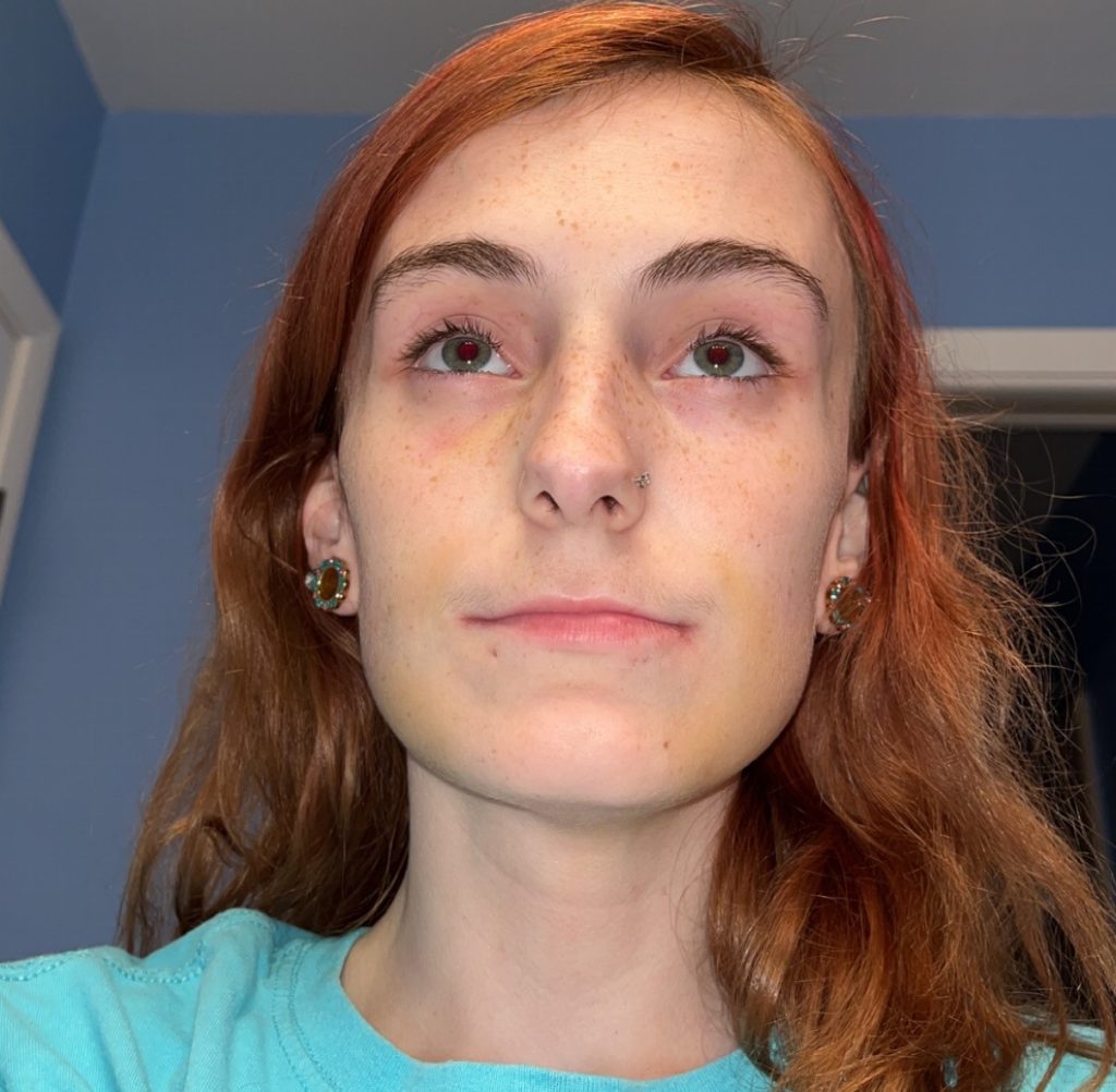 A 25-year-old who had all her teeth pulled at just 22 due to severe vitamin deficiencies is hitting back at cruel online trolls who say she looks 75 and used hard drugs.