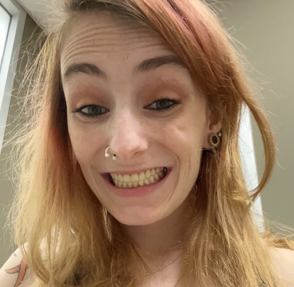 A 25-year-old who had all her teeth pulled at just 22 due to severe vitamin deficiencies is hitting back at cruel online trolls who say she looks 75 and used hard drugs.