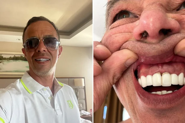 Brit who flew to Turkey for a cheap smile makeover says his teeth are now falling out - and fixing the dental nightmare could cost him up to £40,000.