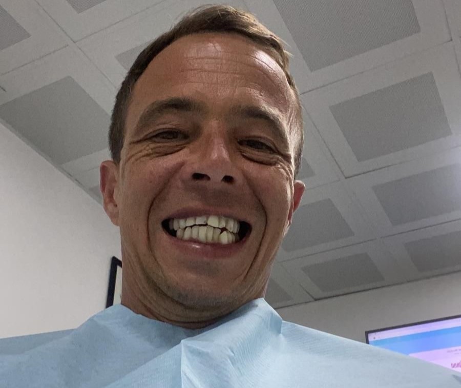 Brit who flew to Turkey for a cheap smile makeover says his teeth are now falling out - and fixing the dental nightmare could cost him up to £40,000.