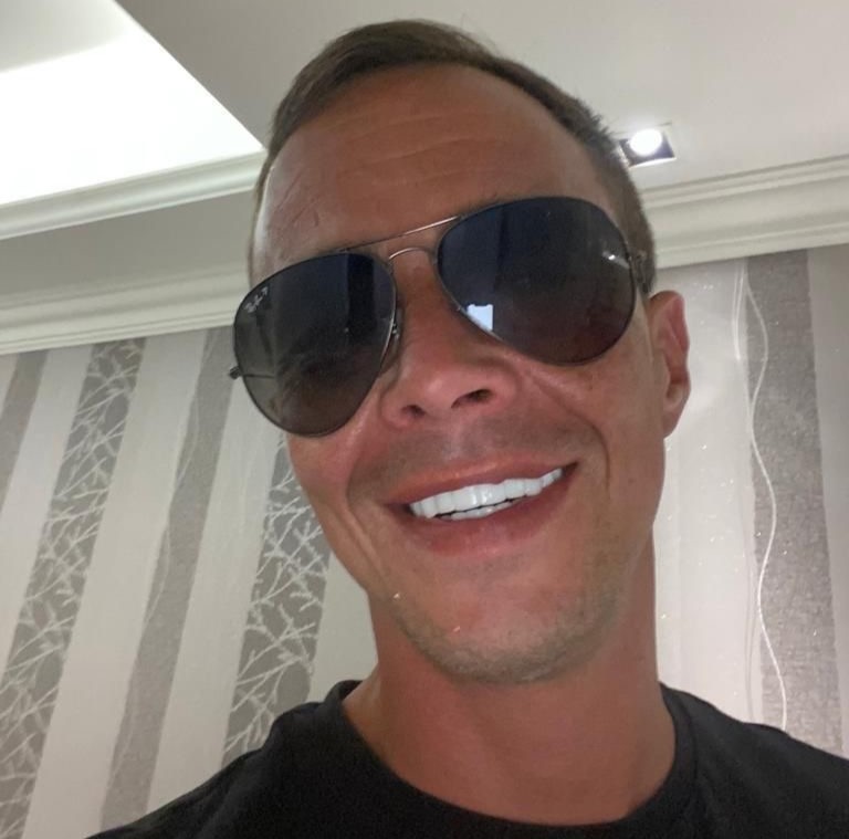Brit who flew to Turkey for a cheap smile makeover says his teeth are now falling out - and fixing the dental nightmare could cost him up to £40,000.