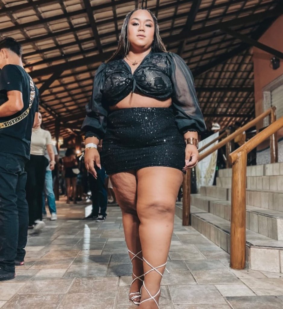 Plus-size model Thaylana Cordeiro, 22, dies after undergoing "dream" weight-loss surgery just hours after excitedly telling friends she was beginning a new chapter in life.