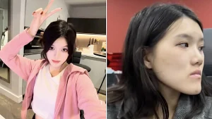 Woman, 24, went in for routine dental fillings but a botched jaw op left her face uneven and looking like an ancient Chinese emperor with a pronounced underbite.
