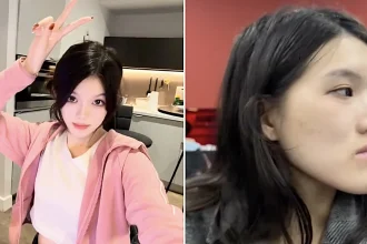 Woman, 24, went in for routine dental fillings but a botched jaw op left her face uneven and looking like an ancient Chinese emperor with a pronounced underbite.