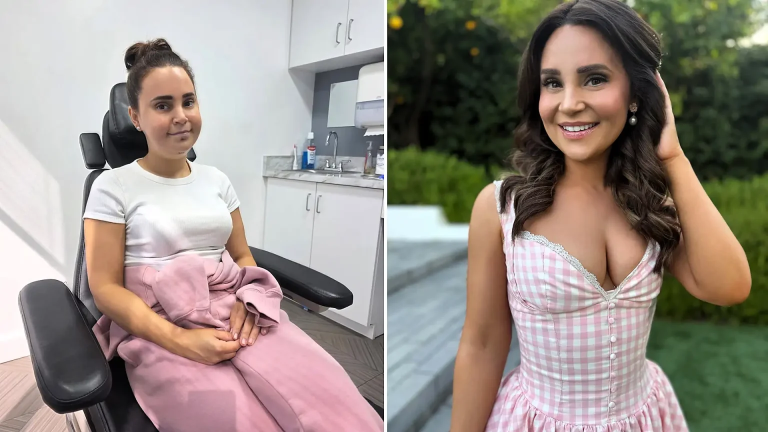 YouTube star Rosanna Pansino shattered her jaw in four places and smashed her front teeth after a horror fall as a boat docked on her birthday - she now has four metal screws in her gums.