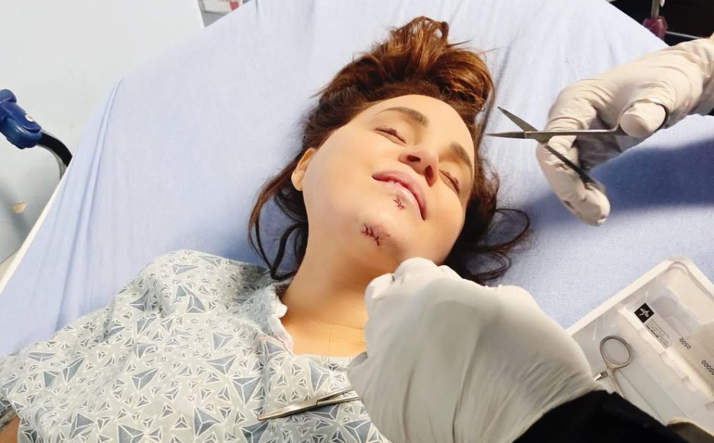 YouTube star Rosanna Pansino shattered her jaw in four places and smashed her front teeth after a horror fall as a boat docked on her birthday - she now has four metal screws in her gums.