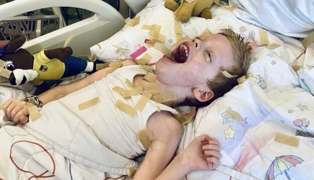 A five-year-old boy with a rare brain disease who became the face of a Dutch fundraising campaign has died at home in his mother's arms - his family helped raise €11m for research.