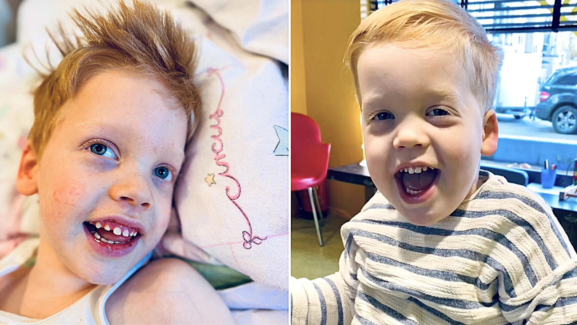 A five-year-old boy with a rare brain disease who became the face of a Dutch fundraising campaign has died at home in his mother's arms - his family helped raise €11m for research.
