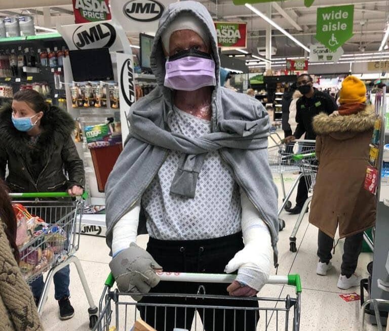 Darren Harris was clinically dead for 14 minutes after 11,000 volts burned him to the bone - now he's undergone 33 surgeries and needs £100,000 for facial reconstruction.