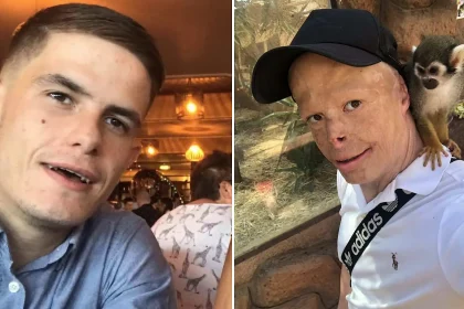Darren Harris was clinically dead for 14 minutes after 11,000 volts burned him to the bone - now he's undergone 33 surgeries and needs £100,000 for facial reconstruction.